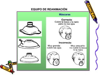 Máscaras
EQUIPO DE REANIMACIÓN
38
 