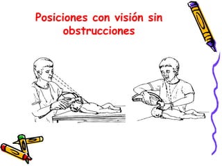Posiciones con visión sin
obstrucciones
 