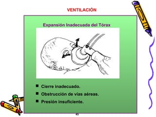  Cierre inadecuado.
 Obstrucción de vías aéreas.
 Presión insuficiente.
VENTILACIÓN
45
Expansión Inadecuada del Tórax
 