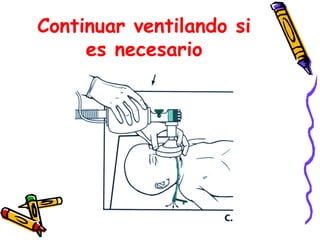 Continuar ventilando si
es necesario
 