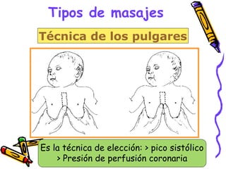 Tipos de masajes
Técnica de los pulgares
Es la técnica de elección: > pico sistólico
> Presión de perfusión coronaria
 