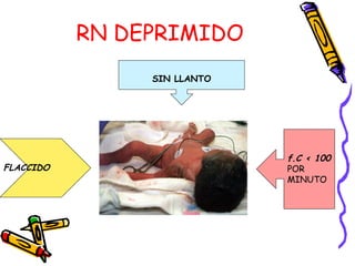 RN DEPRIMIDO
f.C < 100
POR
MINUTO
FLACCIDO
SIN LLANTO
 