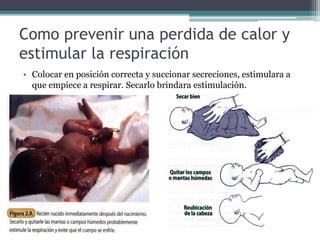 • Colocar en posición correcta y succionar secreciones, estimulara a
que empiece a respirar. Secarlo brindara estimulación.
Como prevenir una perdida de calor y
estimular la respiración
 