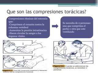 Que son las compresiones torácicas?
Compresiones rítmicas del esternón
que:
-Comprimen el corazón contra la
columna vertebral
-Aumentan la presión intratóracica
-Hacen circular la sangre a los
órganos vitales
Se necesita de 2 personas:
una que comprima el
pecho y otra que este
ventilando
 
