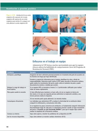 Ventilación a presión positiva
¡gura 4.25. Introducción de una sonda
orogástrica (A), aspiración de la sonda
orogástrica (B), apertura de una sonda
orogástrica para ventilar (C) y asegurar con
cinta adhesiva la sonda orogástrica (D)
Enfocarse en el trabajo en equipo
Administrar la VPP destaca muchas oportunidades para que los equipos
eficaces utilicen las habilidades de comportamiento claves del Programa de
Reanimación Neonatal (PRN).
Conducta Ejemplo
Anticípese y planifique. Asegúrese de tener suficiente personal presente en el momento del parto de acuerdo con
los factores de riesgo que haya identificado.
Durante su exposición informativa para el equipo, planifique los roles y divida las
responsabilidades. Determine quién realiza la VPP, quién ausculta la frecuencia cardíaca,
quién evalúa los movimientos del pecho, quién coloca el oxímetro de pulso y quién
documenta los eventos a medida que ocurren.
Delegue la carga de trabajo en
forma óptima.
Pida ayuda cuando la necesite.
Si se requiere VPP, se necesitan al menos 2 o 3 profesionales calificados para realizar
todas las tareas rápidamente.
Si tiene dificultad para mantener un buen sello, tal vez se requiera la técnica de
dos manos, en la que una segunda persona administra la respiración asistida y una
tercera persona evalúa la respuesta.
Tal vez necesite pedir ayuda adicional si se necesita intubar.
Comuniqúese eficazmente. Los individuos que administran VPP y evalúan la efectividad de la ventilación deben
compartir la información y comunicarse entre ellos.
Si se requieren los pasos correctivos de ventilación, es fundamental compartir información
frecuentemente luego de cada paso. Es importante anunciar cuando se logra movimiento
del pecho [“El pecho se está moviendo AHORA) para que el equipo sepa cuándo
evaluar la respuesta de la frecuencia cardíaca.
Conozca su entorno.
Use los recursos disponibles.
Sepa cómo operar y resolver los problemas de su dispositivo de VPP.
Sepa cómo obtener un monitor cardíaco electrónico (ECG).
ERRNVPHGLFRVRUJ
 