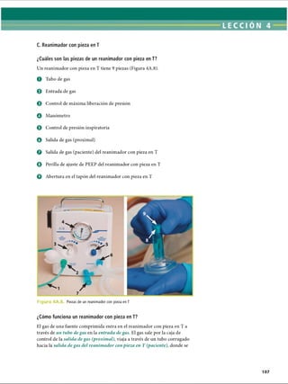 C. Reanimador con pieza en T
¿Cuáles son las piezas de un reanimador con pieza en T?
Un reanimador con pieza en T tiene 9 piezas (Figura 4A.8).
O Tubo de gas
0 Entrada de gas
© Control de máxima liberación de presión
O Manómetro
0 Control de presión inspiratoria
o Salida de gas (proximal)
0 Salida de gas (paciente) del reanimador con pieza en T
© Perilla de ajuste de PEEP del reanimador con pieza en T
0 Abertura en el tapón del reanimador con pieza en T
F ig Piezas de un reanimador con pieza en T
¿Cómo funciona un reanimador con pieza en T?
El gas de una fuente comprimida entra en el reanimador con pieza en T a
través de un tubo de gas en la entrada de gas. El gas sale por la caja de
control de la salida de gas (proximal), viaja a través de un tubo corrugado
hacia la salida de gas del reanimador con pieza en T (paciente), donde se
ERRNVPHGLFRVRUJ
 