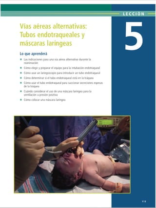 LECCI ÓN
Vías aéreas alternativas
Tubos endotraqueales y
máscaras laríngeas
Lo que aprenderá
Las indicaciones para una vía aérea alternativa durante la
reanimación
Cómo elegir y preparar el equipo para la intubación endotraqueal
Cómo usar un laringoscopio para introducir un tubo endotraqueal
Cómo determinar si el tubo endotraqueal está en la tráquea
Cómo usar el tubo endotraqueal para succionar secreciones espesas
de la tráquea
Cuándo considerar el uso de una máscara laríngea para la
ventilación a presión positiva
Cómo colocar una máscara laríngea
115
ERRNVPHGLFRVRUJ
 