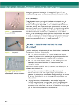 Vías aéreas alternativas: Tubos endotraqueales y máscaras laríngeas
Figura 5 Tubos endotraqueales
(tamaños 2.5, 3.0, 3.5)
Figura b.2 Laringoscopio
F ig u Ejemplos de máscaras
laríngeas neonatales (dispositivos supraglóticos)
de un instrumento con iluminación (laringoscopio, [Figura 5.2]) para
visualizar la laringe y guiar la colocación del tubo entre las cuerdas vocales.
Máscaras laríngeas
Una máscara laríngea es una máscara pequeña conectada a un tubo de
ventilación que se introduce en la boca y se hace avanzar hasta que la
máscara cubre la glotis (Figura 5.3). Se hace avanzar un tubo endotraqueal
a través de la glotis, pero la máscara laríngea permanece por encima de la
glotis, por lo que la máscara laríngea es llamada un dispositivo supraglótico
de ventilación. La máscara laríngea es una alternativa eficaz cuando los
intentos de ventilación con máscara facial e intubación no son exitosos. La
colocación de una máscara facial no requiere la visualización de la laringe o
el uso de un instrumento de inserción. Su uso en recién nacidos prematuros
es limitado, en parte porque el tamaño disponible más pequeño puede ser
demasiado grande para los recién nacidos más pequeños.
¿Cuándo se debería considerar una vía aérea
alternativa?
Se debe considerar la introducción de un tubo endotraqueal o una máscara
laríngea en las siguientes circunstancias:
• Si la VPP con una máscara facial no da como resultado una mejora
clínica, se recomienda enfáticamente el uso de un tubo endotraqueal o
una máscara laríngea para mejorar la eficacia de la ventilación.
• Si la VPP dura más de algunos minutos, un tubo endotraqueal o una
máscara laríngea pueden mejorar la eficacia y la facilidad de la
ventilación asistida.
Se recomienda enfáticamente la introducción de un tubo endotraqueal en
las siguientes circunstancias:
• Si se necesitan compresiones torácicas, un tubo endotraqueal
maximizará la eficacia de cada respiración por presión positiva y le
permitirá al compresor que proporcione compresiones desde la cabecera
de la cama. Si la intubación no es exitosa o posible, se podrá usar una
máscara facial.
• Un tubo endotraqueal proporciona el acceso a las vías aéreas más
confiable en circunstancias especiales, tales como (1) estabilización de
un recién nacido con sospecha de hernia diafragmática, (2) para la
administración de surfactante, y (3) para la succión directa de la tráquea
si la vía aérea está obstruida por secreciones espesas.
118
ERRNVPHGLFRVRUJ
 