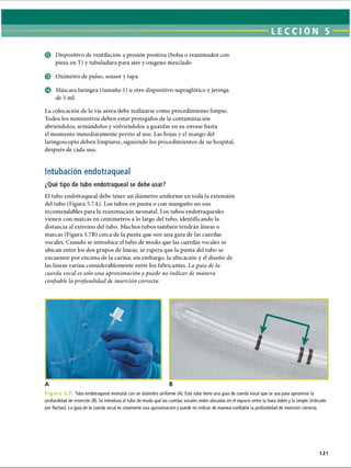 LECCI ÓN 5
© Dispositivo de ventilación a presión positiva (bolsa o reanimador con
pieza en T) y tubuladura para aire y oxígeno mezclado
© Oxímetro de pulso, sensor y tapa
© Máscara laríngea (tamaño 1) u otro dispositivo supraglótico y jeringa
de 5 mi.
La colocación de la vía aérea debe realizarse como procedimiento limpio.
Todos los suministros deben estar protegidos de la contaminación
abriéndolos, armándolos y volviéndolos a guardar en su envase hasta
el momento inmediatamente previo al uso. Las hojas y el mango del
laringoscopio deben limpiarse, siguiendo los procedimientos de su hospital,
después de cada uso.
Intubación endotraqueal
¿Qué tipo de tubo endotraqueal se debe usar?
El tubo endotraqueal debe tener un diámetro uniforme en toda la extensión
del tubo (Figura 5.7A). Los tubos en punta o con manguito no son
recomendables para la reanimación neonatal. Los tubos endotraqueales
vienen con marcas en centímetros a lo largo del tubo, identificando la
distancia al extremo del tubo. Muchos tubos también tendrán líneas o
marcas (Figura 5.7B) cerca de la punta que son una guía de las cuerdas
vocales. Cuando se introduce el tubo de modo que las cuerdas vocales se
ubican entre los dos grupos de líneas, se espera que la punta del tubo se
encuentre por encima de la carina; sin embargo, la ubicación y el diseño de
las líneas varían considerablemente entre los fabricantes. La guía de la
cuerda vocal es solo una aproximación y puede no indicar de manera
confiable la profundidad de inserción correcta.
F i g u r a 5 Tubo endotraqueal neonatal con un diámetro uniforme (A). Este tubo tiene una guía de cuerda vocal que se usa para aproximar la
profundidad de inserción (B). Se introduce el tubo de modo que las cuerdas vocales estén ubicadas en el espacio entre la línea doble y la simple (indicado
por flechas). La guía de la cuerda vocal es solamente una aproximación y puede no indicar de manera confiable la profundidad de inserción correcta.
121
ERRNVPHGLFRVRUJ
 