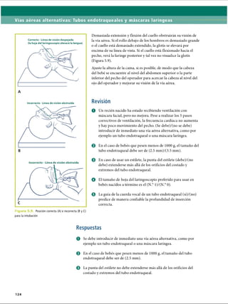 Vías aéreas alternativas: Tubos endotraqueales y máscaras laríngeas
Correcto - Línea de visión despejada
(la hoja del laringoscopio elevará la lengua)
A
Incorrecto - Línea de visión obstruida
B
Incorrecto - Línea de visión obstruida
c
h i g l Posición correcta (A) e incorrecta (B y C)
para la intubación
Demasiada extensión y flexión del cuello obstruirán su visión de
la vía aérea. Si el rollo debajo de los hombros es demasiado grande
o el cuello está demasiado extendido, la glotis se elevará por
encima de su línea de vista. Si el cuello está flexionado hacia el
pecho, verá la faringe posterior y tal vez no visualice la glotis
(Figura 5.9).
Ajuste la altura de la cama, si es posible, de modo que la cabeza
del bebé se encuentre al nivel del abdomen superior o la parte
inferior del pecho del operador para acercar la cabeza al nivel del
ojo del operador y mejorar su visión de la vía aérea.
Revisión
O Un recién nacido ha estado recibiendo ventilación con
máscara facial, pero no mejora. Pese a realizar los 5 pasos
correctivos de ventilación, la frecuencia cardíaca no aumenta
y hay poco movimiento del pecho. (Se debe)/(no se debe)
introducir de inmediato una vía aérea alternativa, como por
ejemplo un tubo endotraqueal o una máscara laríngea.
© En el caso de bebés que pesen menos de 1000 g, el tamaño del
tubo endotraqueal debe ser de (2.5 mm)/(3.5 mm).
0 En caso de usar un estilete, la punta del estilete (debe)/(no
debe) extenderse más allá de los orificios del costado y
extremos del tubo endotraqueal.
o El tamaño de hoja del laringoscopio preferido para usar en
bebés nacidos a término es el (N.° 1)/(N.° 0).
0 La guía de la cuerda vocal de un tubo endotraqueal (sí)/(no)
predice de manera confiable la profundidad de inserción
correcta.
Respuestas
O Se debe introducir de inmediato una vía aérea alternativa, como por
ejemplo un tubo endotraqueal o una máscara laríngea.
0 En el caso de bebés que pesen menos de 1000 g, el tamaño del tubo
endotraqueal debe ser de (2.5 mm).
0 La punta del estilete no debe extenderse más allá de los orificios del
costado y extremos del tubo endotraqueal.
124
ERRNVPHGLFRVRUJ
 