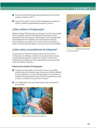 o El tamaño de hoja del laringoscopio preferido para usar en bebés
nacidos a término es el N.° 1.
0 La guía de la cuerda vocal de un tubo endotraqueal no predice de
manera confiable la profundidad de inserción correcta.
¿Cómo sostiene el laringoscopio?
Siempre sostenga el laringoscopio con su mano izquierda con su pulgar
sobre la superficie superior del mango del laringoscopio y la hoja
apuntando en dirección opuesta a usted (Figura 5.10). El laringoscopio
está diseñado para ser sostenido en la mano izquierda, tanto por
usuarios diestros como zurdos. Si lo sostiene en la mano derecha, su
visión a través de la porción abierta y curva de la hoja estará obstruida.
¿Cómo realiza el procedimiento de intubación?
Los pasos para la intubación traqueal se describen brevemente a
continuación; sin embargo, se requiere de una supervisión y práctica
considerables para lograr la competencia. Incluso si usted no está
realizando el procedimiento, es útil comprender los pasos para poder
asistir eficazmente al operador.
F i g u r u 5 .1 0 . Sostenga el laringoscopio
con la mano izquierda.
Prepárese para introducir el laringoscopio.
O Coloque al recién nacido en la posición correcta. Si es posible,
ajuste la altura del calentador según sea necesario. Puede estabilizar
la cabeza del bebé con su mano derecha (Figura 5.11) mientras un
miembro del equipo garantiza que el bebé esté acostado recto y que
la cabeza se encuentre en la posición de “olfateo”
.
© Use el dedo índice de la mano derecha para abrir suavemente la
boca del bebé.
Fie Colocar al bebé en posición para la intubación
125
ERRNVPHGLFRVRUJ
 