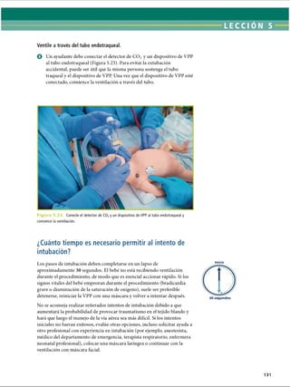 Ventile a través del tubo endotraqueal.
O Un ayudante debe conectar el detector de C 02 y un dispositivo de VPP
al tubo endotraqueal (Figura 5.23). Para evitar la extubación
accidental, puede ser útil que la misma persona sostenga el tubo
traqueal y el dispositivo de VPP. Una vez que el dispositivo de VPP esté
conectado, comience la ventilación a través del tubo.
F i g u r a 5 .2 3 . Conecte el detector de C02y un dispositivo de VPP al tubo endotraqueal y
comience la ventilación.
¿Cuánto tiempo es necesario permitir al intento de
intubación?
Los pasos de intubación deben completarse en un lapso de
aproximadamente 30 segundos. El bebé no está recibiendo ventilación
durante el procedimiento, de modo que es esencial accionar rápido. Si los
signos vitales del bebé empeoran durante el procedimiento (bradicardia
grave o disminución de la saturación de oxígeno), suele ser preferible
detenerse, reiniciar la VPP con una máscara y volver a intentar después.
No se aconseja realizar reiterados intentos de intubación debido a que
aumentará la probabilidad de provocar traumatismo en el tejido blando y
hará que luego el manejo de la vía aérea sea más difícil. Si los intentos
iniciales no fueran exitosos, evalúe otras opciones, incluso solicitar ayuda a
otro profesional con experiencia en intubación (por ejemplo, anestesista,
médico del departamento de emergencia, terapista respiratorio, enfermera
neonatal profesional), colocar una máscara laríngea o continuar con la
ventilación con máscara facial.
Inicio
131
ERRNVPHGLFRVRUJ
 