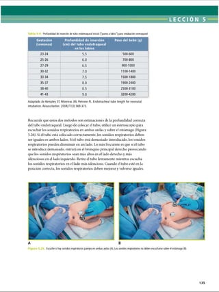 LECCI ÓN 5
Profundidad de inserción de tubo endotraqueal inicial (punta a labio) para intubación orotraqueal
Gestación
(semanas)
Profundidad de inserción
(cm) del tubo endotraqueal
en los labios
Peso del bebé (g)
23-24 5.5 500-600
25-26 6.0 700-800
27-29 6.5 900-1000
30-32 7.0 1100-1400
33-34 7.5 1500-1800
35-37 8.0 1900-2400
38-40 8.5 2500-3100
41-43 9.0 3200-4200
Adaptado de Kempley ST, Moreiras JW, Petrone FL. Endotracheal tube length for neonatal
intubation. Resuscitation. 2008;77(3):369-373.
Recuerde que estos dos métodos son estimaciones de la profundidad correcta
del tubo endotraqueal. Luego de colocar el tubo, utilice un estetoscopio para
escuchar los sonidos respiratorios en ambas axilas y sobre el estómago (Figura
5.26). Si el tubo está colocado correctamente, los sonidos respiratorios deben
ser iguales en ambos lados. Si el tubo está demasiado introducido, los sonidos
respiratorios pueden disminuir en un lado. Lo más frecuente es que si el tubo
se introduce demasiado, entrará en el bronquio principal derecho provocando
que los sonidos respiratorios sean más altos en el lado derecho y más
silenciosos en el lado izquierdo. Retire el tubo lentamente mientras escucha
los sonidos respiratorios en el lado más silencioso. Cuando el tubo esté en la
posición correcta, los sonidos respiratorios deben mejorar y volverse iguales.
Escuche si hay sonidos respiratorios parejos en ambas axilas (A). Los sonidos respiratorios no deben escucharse sobre el estómago (B).
135
ERRNVPHGLFRVRUJ
 
