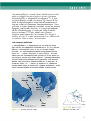 LECCI ON 5
Un ayudante rápidamente prepara la máscara laríngea. Los miembros del
equipo de reanimación introducen la máscara laríngea, conectan un
dispositivo de VPP y un detector de C 02y comienzan la VPP Se nota
movimiento del pecho con cada respiración de VPP, el detector de C 02
cambia de color indicando que la ventilación insufla los pulmones y la
frecuencia cardíaca del bebé aumenta. Aunque comienza a tener esfuerzo
respiratorio espontáneo, el equipo de reanimación sospecha que tiene una
obstrucción congènita de las vías aéreas y se asegura la máscara laríngea y
se la deja colocada mientras se lo transfiere a la unidad de cuidados
intensivos neonatales (UCIN) para realizarle más evaluaciones y
administrar la atención posterior a la reanimación. Poco después, los
miembros del equipo de atención realizan un análisis para hablar sobre la
preparación, el trabajo en equipo y la comunicación.
¿Qué es una máscara laríngea?
La máscara laríngea es un dispositivo para las vías aéreas que es una
alternativa a la máscara facial o al tubo endotraqueal. Hay varios diseños
diferentes, pero un ejemplo común incluye un tubo de ventilación
conectado a una máscara pequeña y flexible con un manguito inflable
(Figura 5.32). La máscara se introduce en la boca del bebé y se la hace
avanzar hasta que la punta casi llegue al esófago. Una vez que la máscara
esté totalmente introducida, se infla el manguito. Un pequeño balón piloto
controla la inflación del manguito. La máscara cubre la glotis (abertura
laríngea) como un tapón y el manguito inflable crea un sello contra la
hipofaringe (Figura 5.33). La abertura de la máscara está cubierta por
barras pequeñas (barras de apertura) que evitan que la epiglotis sea atraída
hacia el tubo de ventilación. El tubo de ventilación tiene un conector
Manguito
inflable
Tubo de
Barra de
apertura
Balón
piloto
Conector de 15 mm
Línea de
inflado
F i g u r a 5 .3 2 Un ejemplo de máscara laríngea
Máscara laríngea
formando un sello sobre la glotis
141
ERRNVPHGLFRVRUJ
 