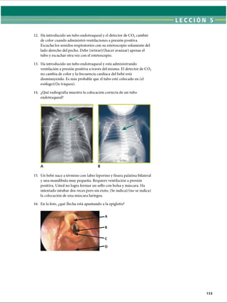 LECCI ÓN 5
12. Ha introducido un tubo endotraqueal y el detector de C 02cambió
de color cuando administró ventilaciones a presión positiva.
Escucha los sonidos respiratorios con su estetoscopio solamente del
lado derecho del pecho. Debe (retirar)/(hacer avanzar) apenas el
tubo y escuchar otra vez con el estetoscopio.
13. Ha introducido un tubo endotraqueal y está administrando
ventilación a presión positiva a través del mismo. El detector de C 02
no cambia de color y la frecuencia cardíaca del bebé está
disminuyendo. Es más probable que el tubo esté colocado en (el
esófago)/(la tráquea).
14. ¿Qué radiografía muestra la colocación correcta de un tubo
endotraqueal?
A B
15. Un bebé nace a término con labio leporino y fisura palatina bilateral
y una mandíbula muy pequeña. Requiere ventilación a presión
positiva. Usted no logra formar un sello con bolsa y máscara. Ha
intentado intubar dos veces pero sin éxito. (Se indica)/(no se indica)
la colocación de una máscara laríngea.
16. En la foto, ¿qué flecha está apuntando a la epiglotis?
A
B
C
D
153
ERRNVPHGLFRVRUJ
 