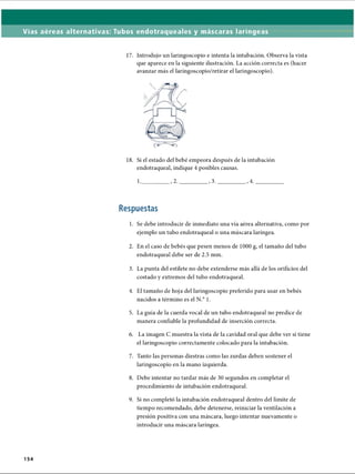 Vías aéreas alternativas: Tubos endotraqueales y máscaras laríngeas
17. Introdujo un laringoscopio e intenta la intubación. Observa la vista
que aparece en la siguiente ilustración. La acción correcta es (hacer
avanzar más el laringoscopio/retirar el laringoscopio).
18. Si el estado del bebé empeora después de la intubación
endotraqueal, indique 4 posibles causas.
1._________, 2._________ , 3._________ , 4._________
Respuestas
1. Se debe introducir de inmediato una vía aérea alternativa, como por
ejemplo un tubo endotraqueal o una máscara laríngea.
2. En el caso de bebés que pesen menos de 1000 g, el tamaño del tubo
endotraqueal debe ser de 2.5 mm.
3. La punta del estilete no debe extenderse más allá de los orificios del
costado y extremos del tubo endotraqueal.
4. El tamaño de hoja del laringoscopio preferido para usar en bebés
nacidos a término es el N.° 1.
5. La guía de la cuerda vocal de un tubo endotraqueal no predice de
manera confiable la profundidad de inserción correcta.
6. La imagen C muestra la vista de la cavidad oral que debe ver si tiene
el laringoscopio correctamente colocado para la intubación.
7. Tanto las personas diestras como las zurdas deben sostener el
laringoscopio en la mano izquierda.
8. Debe intentar no tardar más de 30 segundos en completar el
procedimiento de intubación endotraqueal.9
9. Si no completó la intubación endotraqueal dentro del límite de
tiempo recomendado, debe detenerse, reiniciar la ventilación a
presión positiva con una máscara, luego intentar nuevamente o
introducir una máscara laríngea.
154
ERRNVPHGLFRVRUJ
 
