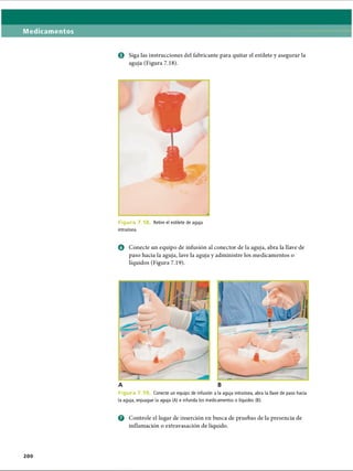 Medicamentos
0 Siga las instrucciones del fabricante para quitar el estilete y asegurar la
aguja (Figura 7.18).
Figurd 7.1 Retire el estilete de aguja
intraósea.
o Conecte un equipo de infusión al collector de la aguja, abra la llave de
paso hacia la aguja, lave la aguja y administre los medicamentos o
líquidos (Figura 7.19).
Figura 7. Conecte un equipo de infusión a la aguja intraósea, abra la llave de paso hacia
la aguja, enjuague la aguja (A) e infunda los medicamentos o líquidos (B).
o Controle el lugar de inserción en busca de pruebas de la presencia de
inflamación o extravasación de líquido.
2 0 0
ERRNVPHGLFRVRUJ
 