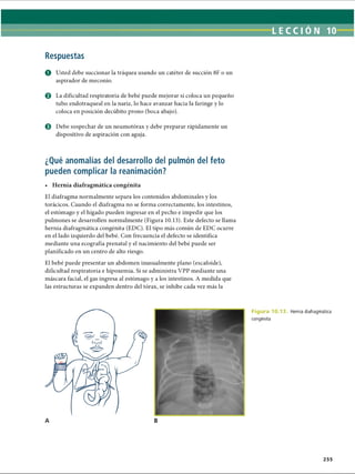 LECCI ÓN 10
Respuestas
O Usted debe succionar la tráquea usando un catéter de succión 8F o un
aspirador de meconio.
© La dificultad respiratoria de bebé puede mejorar si coloca un pequeño
tubo endotraqueal en la nariz, lo hace avanzar hacia la faringe y lo
coloca en posición decúbito prono (boca abajo).
© Debe sospechar de un neumotorax y debe preparar rápidamente un
dispositivo de aspiración con aguja.
¿Qué anomalías del desarrollo del pulmón del feto
pueden complicar la reanimación?
• Hernia diafragmática congènita
El diafragma normalmente separa los contenidos abdominales y los
torácicos. Cuando el diafragma no se forma correctamente, los intestinos,
el estómago y el hígado pueden ingresar en el pecho e impedir que los
pulmones se desarrollen normalmente (Figura 10.13). Este defecto se llama
hernia diafragmática congènita (EDC). El tipo más común de EDC ocurre
en el lado izquierdo del bebé. Con frecuencia el defecto se identifica
mediante una ecografía prenatal y el nacimiento del bebé puede ser
planificado en un centro de alto riesgo.
El bebé puede presentar un abdomen inusualmente plano (escafoide),
dificultad respiratoria e hipoxemia. Si se administra VPP mediante una
máscara facial, el gas ingresa al estómago y a los intestinos. A medida que
las estructuras se expanden dentro del tórax, se inhibe cada vez más la
A
Figura 10.13.
congènita
Hernia diafragmática
255
ERRNVPHGLFRVRUJ
 