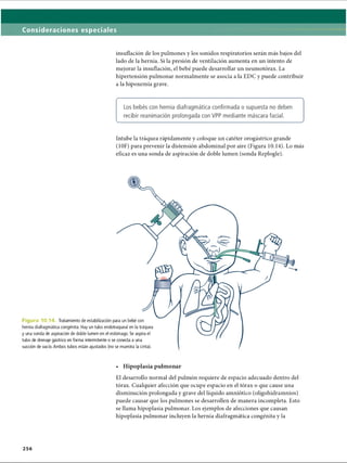 Consideraciones especiales
insuflación de los pulmones y los sonidos respiratorios serán más bajos del
lado de la hernia. Si la presión de ventilación aumenta en un intento de
mejorar la insuflación, el bebé puede desarrollar un neumotorax. La
hipertensión pulmonar normalmente se asocia a la EDC y puede contribuir
a la hipoxemia grave.
C-----------------------------------------------------------------------------------------------------------------------------------------------------------------------------------------------------------
Los bebés con hernia diafragmática confirmada o supuesta no deben
recibir reanimación prolongada con VPP mediante máscara facial.
v__________________________________________________________________________________________________y
Intube la tráquea rápidamente y coloque un catéter orogástrico grande
(10F) para prevenir la distensión abdominal por aire (Figura 10.14). Lo más
eficaz es una sonda de aspiración de doble lumen (sonda Replogle).
Figura 10.14. Tratamiento de estabilización para un bebé con
hernia diafragmática congènita. Hay un tubo endotraqueal en la tráquea
y una sonda de aspiración de doble lumen en el estómago. Se aspira el
tubo de drenaje gástrico en forma intermitente o se conecta a una
succión de vacío.Ambos tubos están ajustados (no se muestra la cinta).•
• Hipoplasia pulmonar
El desarrollo normal del pulmón requiere de espacio adecuado dentro del
tórax. Cualquier afección que ocupe espacio en el tórax o que cause una
disminución prolongada y grave del líquido amniotico (oligohidramnios)
puede causar que los pulmones se desarrollen de manera incompleta. Esto
se llama hipoplasia pulmonar. Los ejemplos de afecciones que causan
hipoplasia pulmonar incluyen la hernia diafragmática congènita y la
2 5 6
ERRNVPHGLFRVRUJ
 