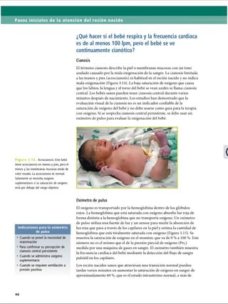 Pasos iniciales de la atención del recién nacido
¿Qué hacer si el bebé respira y la frecuencia cardíaca
es de al menos 100 Ipm, pero el bebé se ve
continuamente cianótico?
Cianosis
El término cianosis describe la piel o membranas mucosas con un tono
azulado causado por la mala oxigenación de la sangre. La cianosis limitada
a las manos y pies (acrocianosis) es habitual en el recién nacido y no indica
mala oxigenación (Figura 3.14). La baja saturación de oxígeno que causa
que los labios, la lengua y el torso del bebé se vean azules se llama cianosis
central. Los bebés sanos pueden tener cianosis central durante varios
minutos después de nacimiento. Los estudios han demostrado que la
evaluación visual de la cianosis no es un indicador confiable de la
saturación de oxígeno del bebé y no debe usarse como guía para la terapia
con oxígeno. Si se sospecha cianosis central persistente, se debe usar un
oxímetro de pulso para evaluar la oxigenación del bebé.
i u ra 3 . 1 1 Acrocianosis. Este bebé
tiene acrocianosis en manos y pies, pero el
tronco y las membranas mucosas están de
color rosado. La acrocianosis es normal.
Solamente se necesita oxígeno
suplementario si la saturación de oxígeno
está por debajo del rango objetivo.
Indicaciones para la oximetría
de pulso
• Cuando se prevé la necesidad de
reanimación
• Para confirmar su percepción de
cianosis central persistente
• Cuando se administra oxígeno
suplementario
• Cuando se requiere ventilación a
presión positiva
Oxímetro de pulso
El oxígeno es transportado por la hemoglobina dentro de los glóbulos
rojos. La hemoglobina que está saturada con oxígeno absorbe luz roja de
forma distinta a la hemoglobina que no transporta oxígeno. Un oxímetro
de pulso utiliza una fuente de luz y un sensor para medir la absorción de
luz roja que pasa a través de los capilares en la piel y estima la cantidad de
hemoglobina que está totalmente saturada con oxígeno (Figura 3.15). Se
muestra la saturación de oxígeno en el monitor, que va de 0 % a 100 %. Este
número no es el mismo que el de la presión parcial de oxígeno (Po2)
medida por una máquina de gases en sangre. El oxímetro también muestra
la frecuencia cardíaca del bebé mediante la detección del flujo de sangre
pulsátil en los capilares.
Los recién nacidos sanos que atraviesan una transición normal pueden
tardar varios minutos en aumentar la saturación de oxígeno en sangre de
aproximadamente 60 %, que es el estado intrauterino normal, a más de
46
ERRNVPHGLFRVRUJ
 
