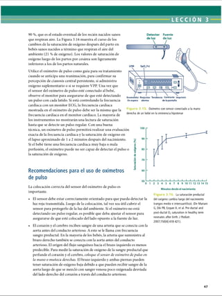 LECCI ÓN 3
90 %, que es el estado eventual de los recién nacidos sanos
que respiran aire. La Figura 3.16 muestra el curso de los
cambios de la saturación de oxígeno después del parto en
bebés sanos nacidos a término que respiran el aire del
ambiente (21 % de oxígeno). Los valores de saturación de
oxígeno luego de los partos por cesárea son ligeramente
inferiores a los de los partos naturales.
Utilice el oxímetro de pulso como guía para su tratamiento
cuando se anticipa una reanimación, para confirmar su
percepción de cianosis central persistente, si administra
oxígeno suplementario o si se requiere VPP. Una vez que
el sensor del oxímetro de pulso esté conectado al bebé,
observe el monitor para asegurarse de que esté detectando
un pulso con cada latido. Si está controlando la frecuencia
cardíaca con un monitor ECG, la frecuencia cardíaca
mostrada en el oxímetro de pulso debe ser la misma que la
frecuencia cardíaca en el monitor cardíaco. La mayoría de
los instrumentos no mostrarán una lectura de saturación
hasta que se detecte un pulso regular. Con una buena
técnica, un oxímetro de pulso permitirá realizar una evaluación
exacta de la frecuencia cardíaca y la saturación de oxígeno en
el lapso aproximado de 1a 2 minutos después del nacimiento.
Si el bebé tiene una frecuencia cardíaca muy baja o mala
perfusión, el oxímetro puede no ser capaz de detectar el pulso o
la saturación de oxígeno.
Fuente
de luz
Encendido/ Reajustar Tendencia Contraste Imprimir
En espera alarma de la pantalla
F ig u ra 3 , 1 5 . Oxímetro con sensor conectado a la mano
derecha de un bebé en la eminencia hipotenar
loo r-
# 9 0
Recomendaciones para el uso de oxímetros
de pulso
O
c
a

en
X
O
■
8
C
'O
5
3
3
80 -
70 -
60 
50 _ l_
_ I__I__ I__ I___ I__ I__I__ I___ I_
_ I_
_ I_
_ I_
_ I_
_ I
0 1 2 3 4 5 6 7 8 9 10 11 12 13 14 15
La colocación correcta del sensor del oxímetro de pulso es
importante.
• El sensor debe estar correctamente orientado para que pueda detectar la
luz roja transmitida. Luego de la colocación, tal vez sea útil cubrir el
sensor para protegerlo de la luz del ambiente. Si el oxímetro no está
detectando un pulso regular, es posible que deba ajustar el sensor para
asegurarse de que esté colocado del lado opuesto a la fuente de luz.
Minutos desde el nacimiento
Figura 3.16. La saturación preductal
del oxígeno cambia luego del nacimiento
(rangos medio e intercuartílico). (De Mariani
G, Dik PB, Ezquer A, et al. Pre-ductal and
post-ductal 0 2 saturation in healthy term
neonates after birth. J Pediatr.
2007;150[4]:418-421).
• El corazón y el cerebro reciben sangre de una arteria que se conecta con la
aorta antes del conducto arterioso. A esto se le llama con frecuencia
sangre preductal. En la mayoría de los bebés, la arteria que suministra al
brazo derecho también se conecta con la aorta antes del conducto
arterioso. El origen del flujo sanguíneo hacia el brazo izquierdo es menos
predecible. Para medir la saturación de oxígeno de la sangre preductal que
perfunde el corazón y el cerebro, coloque el sensor de oxímetro depulso en
la mano o muñeca derechas. El brazo izquierdo y ambas piernas pueden
tener saturación de oxígeno baja debido a que pueden recibir sangre de la
aorta luego de que se mezcló con sangre venosa poco oxigenada desviada
del lado derecho del corazón a través del conducto arterioso.
47
ERRNVPHGLFRVRUJ
 