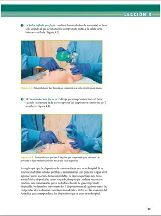 © La bolsa inflada porflujo (también llamada bolsa de anestesia) se llena
sólo cuando el gas de una fuente comprimida entra y la salida de la
bolsa está sellada (Figura 4.3).
Bolsa inflada por flujo. Necesita gas comprimido y un sello hermético para llenarse.
© El reanimador con pieza en T dirige gas comprimido hacia el bebé
cuando la abertura en la parte superior del dispositivo con forma de T
se ocluye (Figura 4.4).
F k Reanimador con pieza en T. Requiere gas comprimido para funcionar. Las
presiones se fijan mediante controles mecánicos en el dispositivo.
Averigüe qué tipo de dispositivo de reanimación se usa en su hospital. Si su
hospital usa bolsas infladas por flujo o reanimadores con pieza en T, igual debe
aprender cómo usar una bolsa autoinflable. Es preciso que haya una bolsa
autoinflable a disposición, como respaldo, siempre que pudiera necesitarse
practicar ima reanimación, por si no hubiese fuente de gas comprimido
disponible. Se describen brevemente los 3 dispositivos en el siguiente texto. En
el Apéndice de esta lección encontrará más detalles. Debe leer las secciones del
Apéndice que correspondan a los dispositivos que se usen en su hospital.
ERRNVPHGLFRVRUJ
 