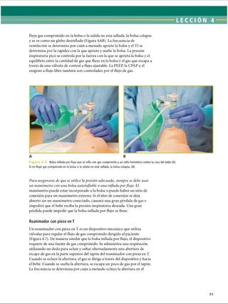 fluye gas comprimido en la bolsa o la salida no está sellada, la bolsa colapsa
y se ve como un globo desinflado (Figura 4.6B). La frecuencia de
ventilación se determina por cuán a menudo apriete la bolsa y el TI se
determina por la rapidez con la que apriete y suelte la bolsa. La presión
inspiratoria pico se controla por la fuerza con la que se aprieta la bolsa y el
equilibrio entre la cantidad de gas que fluye en la bolsa y el gas que escapa a
través de una válvula de control a flujo ajustable. La PEEP, la CPAP y el
oxígeno a flujo libre también son controlados por el flujo de gas.
A B
F i g u r a 4.3 Bolsa inflada por flujo que se infla con gas comprimido y un sello hermético contra la cara del bebé (A).
Si no fluye gas comprimido en la bolsa o la salida no está sellada, la bolsa colapsa. (B).
Para asegurarse de que se utilice la presión adecuada, siempre se debe usar
un manómetro con una bolsa autoinflable o una inflada porflujo. El
manómetro puede estar incorporado a la bolsa o puede haber un sitio de
conexión para un manómetro externo. Si el sitio de conexión se deja
abierto sin un manómetro conectado, causará una gran pérdida de gas e
impedirá que el bebé reciba la presión inspiratoria deseada. Una gran
pérdida puede impedir que la bolsa inflada por flujo se llene.
Reanimador con pieza en T
Un reanimador con pieza en T es un dispositivo mecánico que utiliza
válvulas para regular el flujo de gas comprimido dirigido al paciente
(Figura 4.7). De manera similar que la bolsa inflada por flujo, el dispositivo
requiere de una fuente de gas comprimido. Se administra una respiración
utilizando un dedo para ocluir y soltar alternadamente una abertura de
escape de gas en la parte superior del tapón del reanimador con pieza en T.
Cuando se ocluye la abertura, el gas se dirige a través del dispositivo y hacia
el bebé. Cuando se suelta la abertura, se escapa un poco de gas por el tapón.
La frecuencia se determina por cuán a menudo ocluya la abertura en el
71
ERRNVPHGLFRVRUJ
 