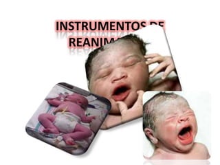 FC  > 100 detenerla ventilación con presiónpositiva.