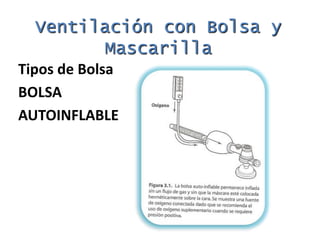 Linea de tiempo – 30 segundos de no mejorìa se procede al pasosiguiente.PasosInicialesDecidirsi la resucitaciónesnecesaria.Abrir la víaaérea.Manejo del meconiosiestápresente.Proporcionaroxígeno a flujolibre.