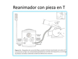 ProveercalorPrevenir la pérdida de calorColocar al reciénnacidobajounacuna de calorradiante.Secarlo, frotarloRemover toallahúmeda.
