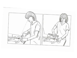 MeconioPresente y reciénnacido  no vigorosoSucción TraquealAdministrar  oxígenoIntroducir laringoscopio, use  sonda de aspirar 12F or 14F para limpiar la bocaIntroduzca el tubo endotraqueal Adapte el tubo endotraqueal al aspiradorRetire el tubo mientras aspire Repita si es necesario