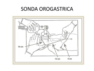 Ventilación con Bolsa y MascarillaIndicaciones:
