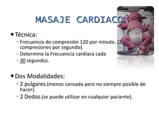 Si se utiliza sin reservorio de oxígeno, dara FiO² de 30-40% al paciente.Bolsa inflada por flujo