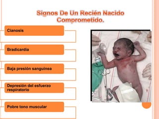 La sangre pasa a los pulmones para recoger oxigeno.Los mayores cambios ocurren dentro de  los primeros segundos después de nacido: Líquido en los alveolos es absorbido Se contraen arterias y vena umbilical  Vasos sanguíneos pulmonares se relajan