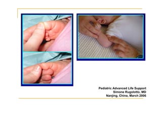 Pediatric Advanced Life Support
Simone Rugolotto, MD
Nanjing, China, March 2006
 