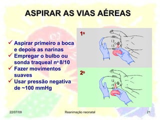ASPIRAR AS VIAS AÉREAS 22/07/09 Reanimação neonatal 1 o 2 o Aspirar primeiro a boca e depois as narinas Empregar o bulbo ou sonda traqueal n o  8/10 Fazer movimentos suaves Usar pressão negativa de  ~ 100 mmHg 