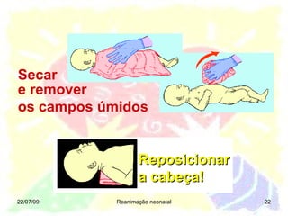 22/07/09 Reanimação neonatal Secar e remover os campos úmidos Reposicionar a cabeça! 