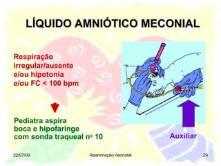 LÍQUIDO AMNIÓTICO MECONIAL 22/07/09 Reanimação neonatal Pediatra aspira  boca e hipofaringe  com sonda traqueal n o  10 Auxiliar Respiração irregular/ausente e/ou hipotonia e/ou   FC < 100 bpm 