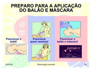 PREPARO PARA A APLICAÇÃO DO BALÃO E MÁSCARA 22/07/09 Reanimação neonatal Posicionar o bebê! Posicionar quem reanima! EVITAR !!! EVITAR !!! Posicionar o balão e máscara! 