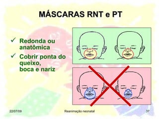 MÁSCARAS RNT e PT 22/07/09 Reanimação neonatal Redonda ou anatômica Cobrir ponta do queixo,  boca e nariz 