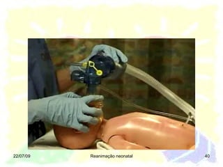 22/07/09 Reanimação neonatal 