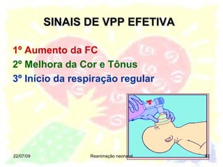 SINAIS DE VPP EFETIVA 22/07/09 Reanimação neonatal 1º Aumento da FC  2º Melhora da Cor e Tônus 3º Início da respiração regular 