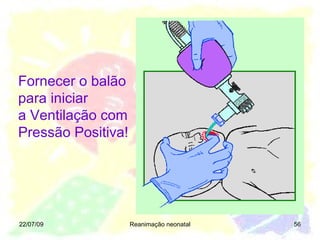 22/07/09 Reanimação neonatal Fornecer o balão para iniciar  a Ventilação com Pressão Positiva! 