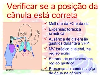 22/07/09 Reanimação neonatal Melhora da FC e da cor Expansão torácica simétrica   Ausência de distensão gástrica durante a VPP MV torácico bilateral, na região axilar Entrada de ar ausente na região gástrica Presença de condensação de água na cânula Verificar se a posição da cânula está correta 