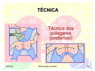TÉCNICA Técnica dos polegares (preferível) 22/07/09 Reanimação neonatal 