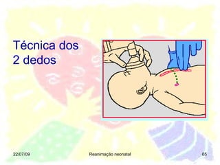 22/07/09 Reanimação neonatal Técnica dos 2 dedos 
