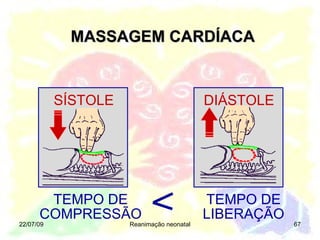 MASSAGEM CARDÍACA 22/07/09 Reanimação neonatal TEMPO DE COMPRESSÃO SÍSTOLE DIÁSTOLE TEMPO DE LIBERAÇÃO 