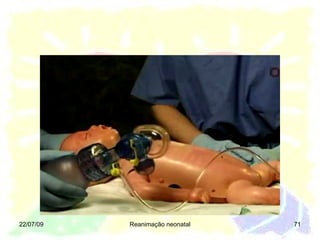 22/07/09 Reanimação neonatal 