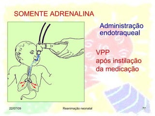 22/07/09 Reanimação neonatal VPP  após instilação da medicação SOMENTE ADRENALINA Administração endotraqueal 
