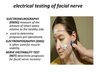 Reanimation of facial paralysis | PPT
